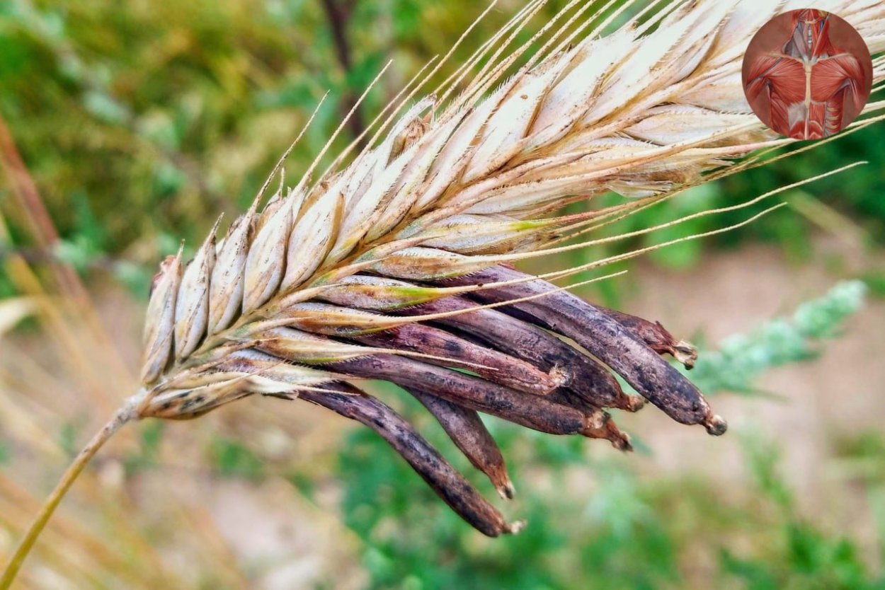 Claviceps purpurea – спорынья пурпурная