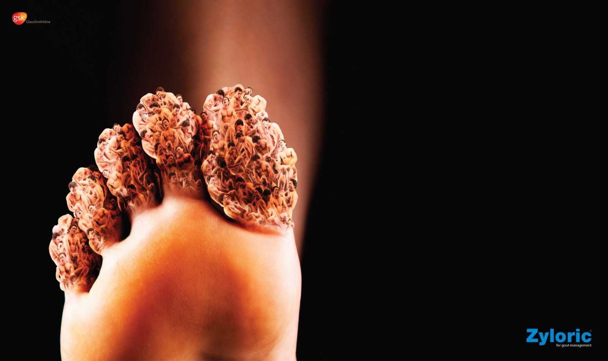 Страшные кожные заболевания